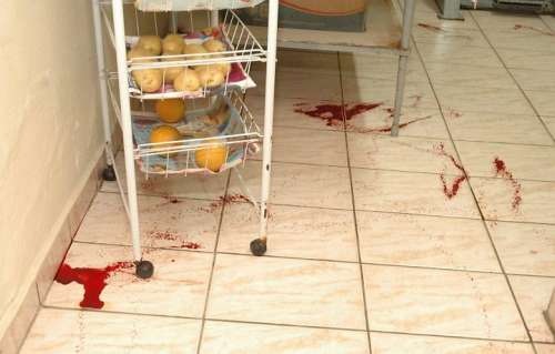 20_MHG_sp_sangue1