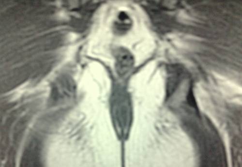 crucifiedalienscan432