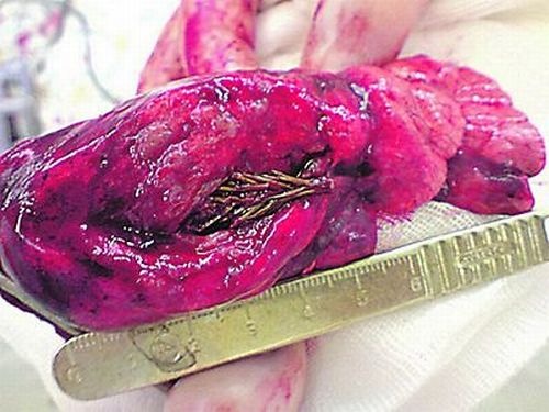 galhopulmao